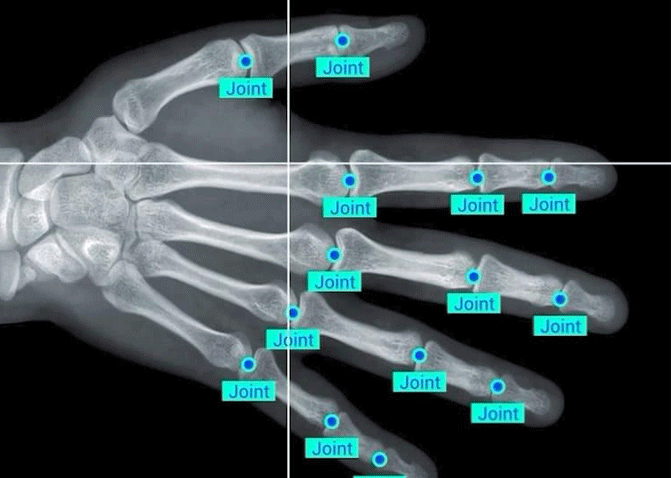 healthcare annotation